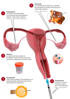 Foto CEFER Instituto de Reproducci�n